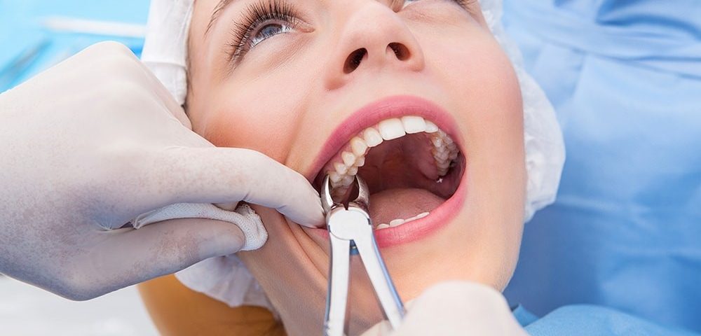 Understanding Calculus and the Importance of Regular Removal for Dental Health