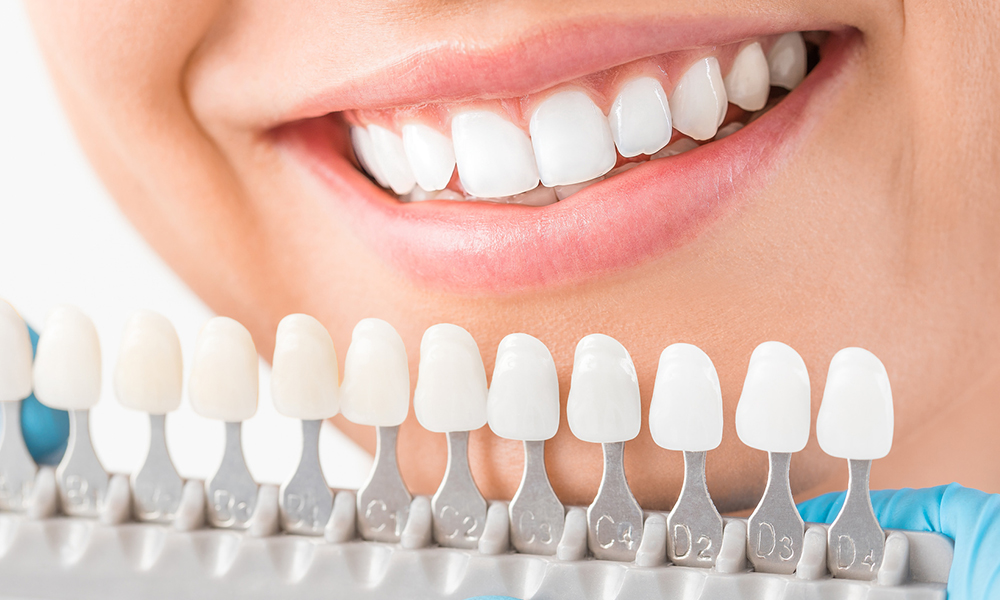 Cosmetic Dentistry in Plymouth