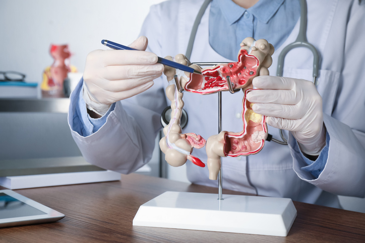 Gastroenterologists And The Fight Against Esophageal Cancer